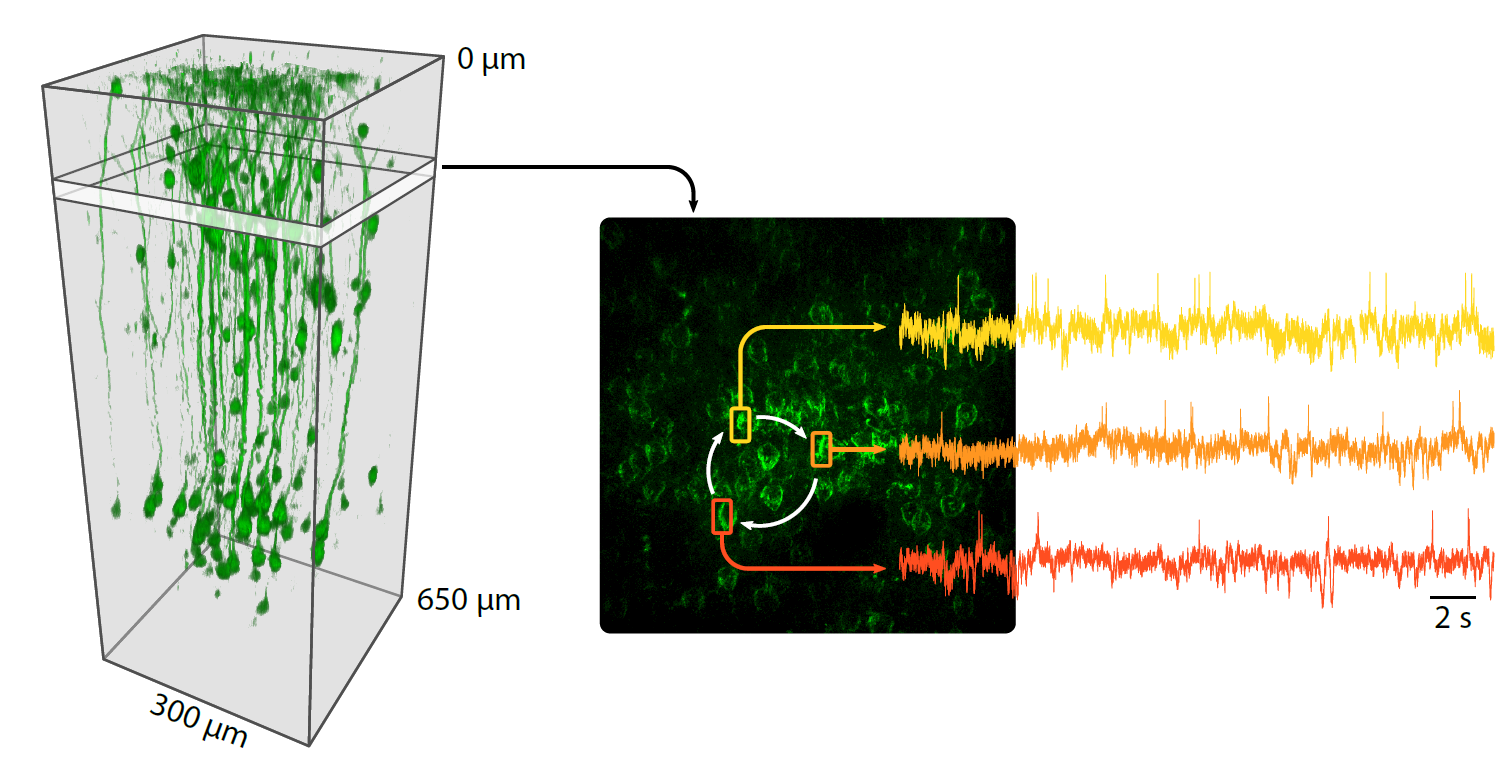 Voir l’activité électrique du cerveau 