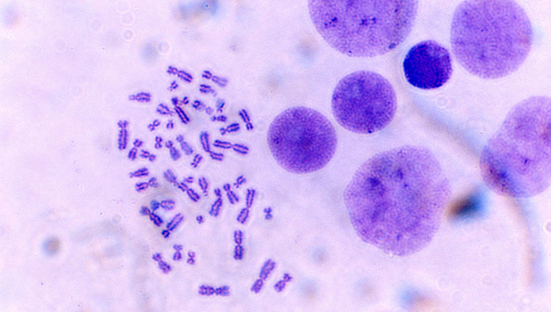 Caryotype humain cc Wikimedia Commons - Josef Reischig