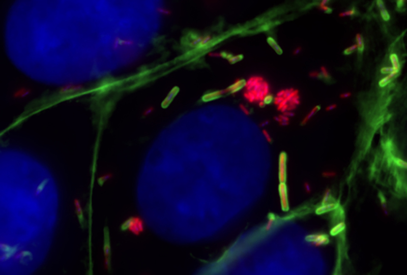 Croissance de Listeria monocytogenes à l'intérieur de vacuoles 