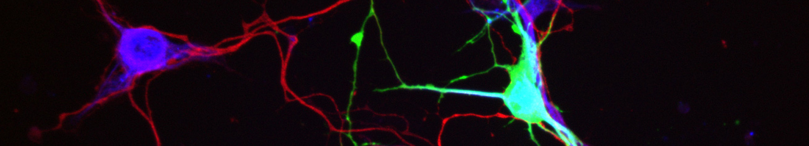 neuropsychologie interventionnelle
