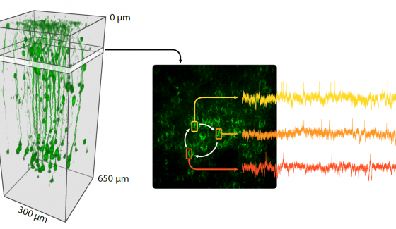 Voir l’activité électrique du cerveau 