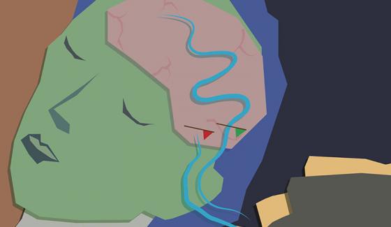 Le cerveau rêveur se coupe du monde extérieur