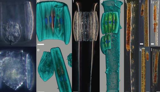 Publication_epibiotic-life